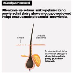 L'Oreal Professionnel, Serie Expert Scalp Advanced, Hair Leave-In Cream Treatment, Anti-Discomfort, 200 ml For Women