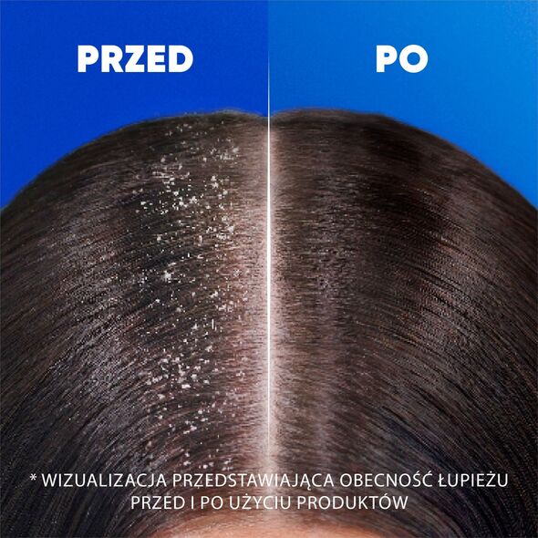 head & shoulders Plaukų šampūnas Head&Shoulders Citrus Fresh, 800 ml