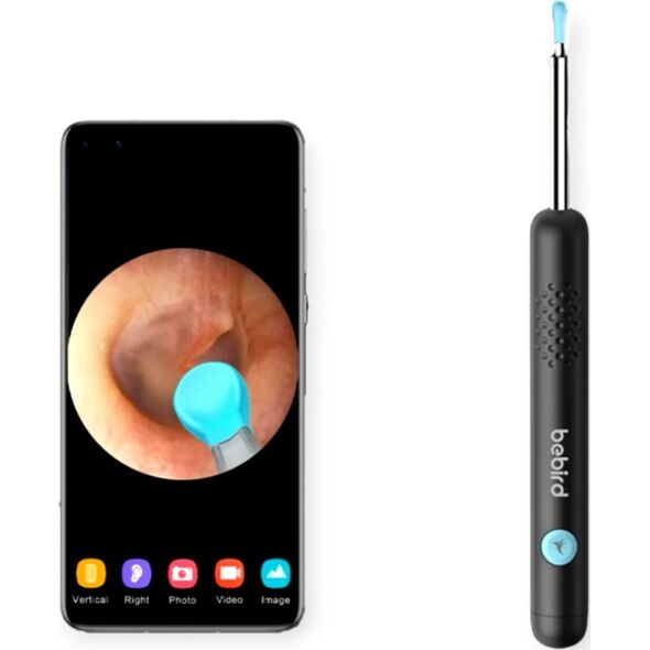 Bebird Otoskop z kamerą do czyszczenia uszu Bebird R1 (czarny)