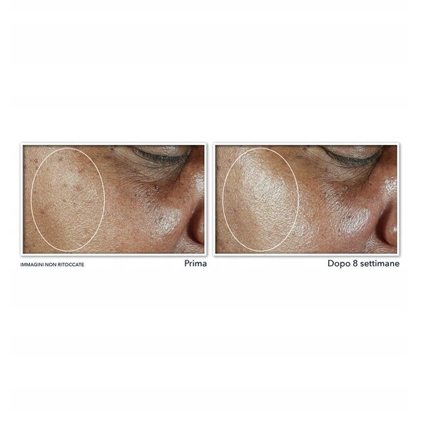 RoC Multi Correxion Even Tone Lift Daily Moisturiser SPF30