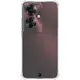 Bizon Case Clear Pack case + 2x screen film Oppo Reno11 F 5G clear